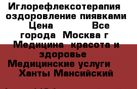 Иглорефлексотерапия, оздоровление пиявками › Цена ­ 3 000 - Все города, Москва г. Медицина, красота и здоровье » Медицинские услуги   . Ханты-Мансийский